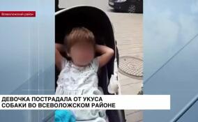 В Мурино соседская собака укусила ребенка за лицо